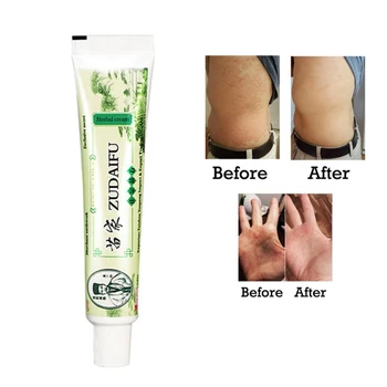 

Skin Psoriasis Cream Dermatitis Eczematoid Eczema Ointment Treatment Herbal Psoriasis Cream Body Skin Care Cream Dropshipping Y1