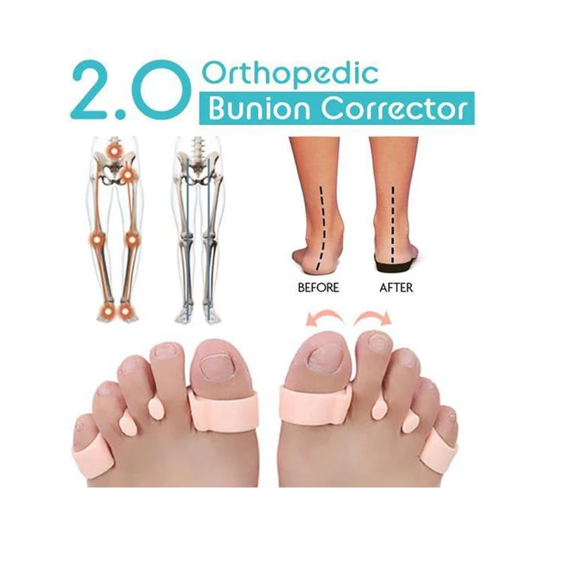 

Orthopedic Bunion Corrector 2.0 (left+right)