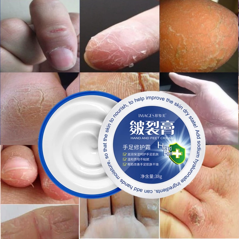 

38g Feet Cream Anti Dry Crack Repair Heel Feet Hand Care Foot Exfoliating Winter Foot Hand Cracked Heel Cream