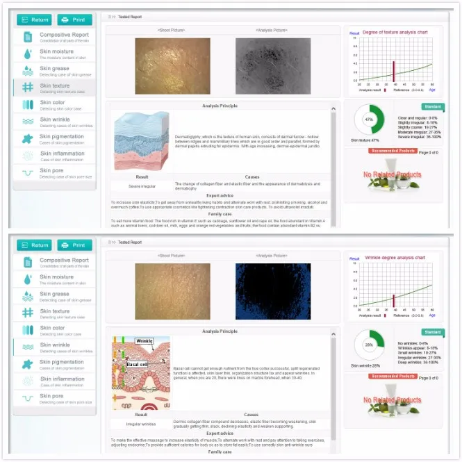 Skin Analysis Chart