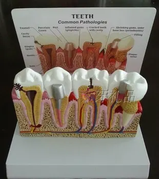 

Detachable tooth anatomical model seat Teeth common pathologies Dentistry Dental model