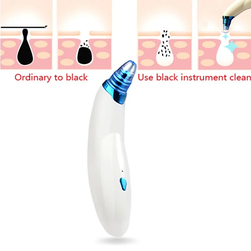 

Face Nose Blackhead Remover Cleaner Vacuum Acne Pimples Eliminator Cleanser Black Head Remover Skin Care Tools
