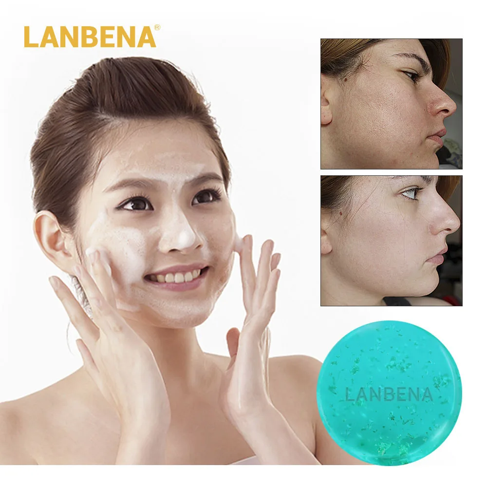 

LANBENA 24K Gold Hyaluronic Acid Handmade Soap Face Cleaning Moisturizing Acne Treatment Repair Whitening Anti-Aning Winkles