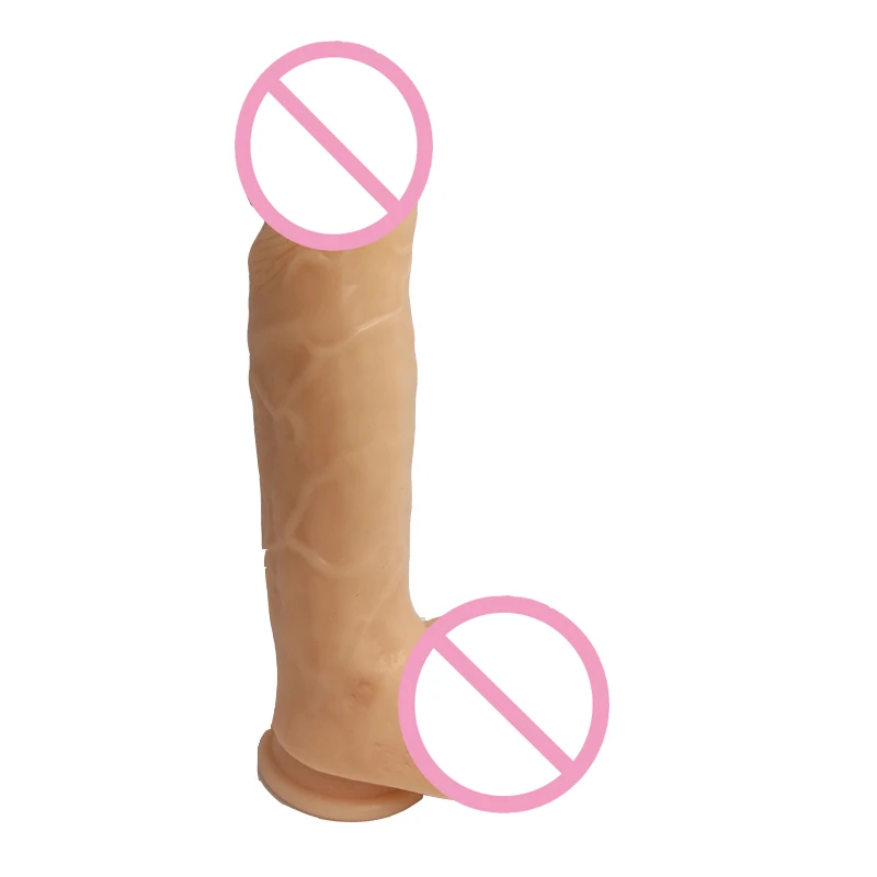 867