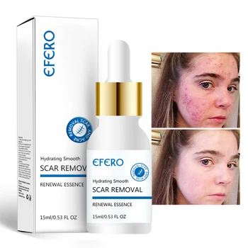 

5pcs EFERO Hyaluronic Acid Shrink Pores Serum Moisturizing Face Serum Whitening Skin Care Repair Anti Aging Anti Wrinkle Serum