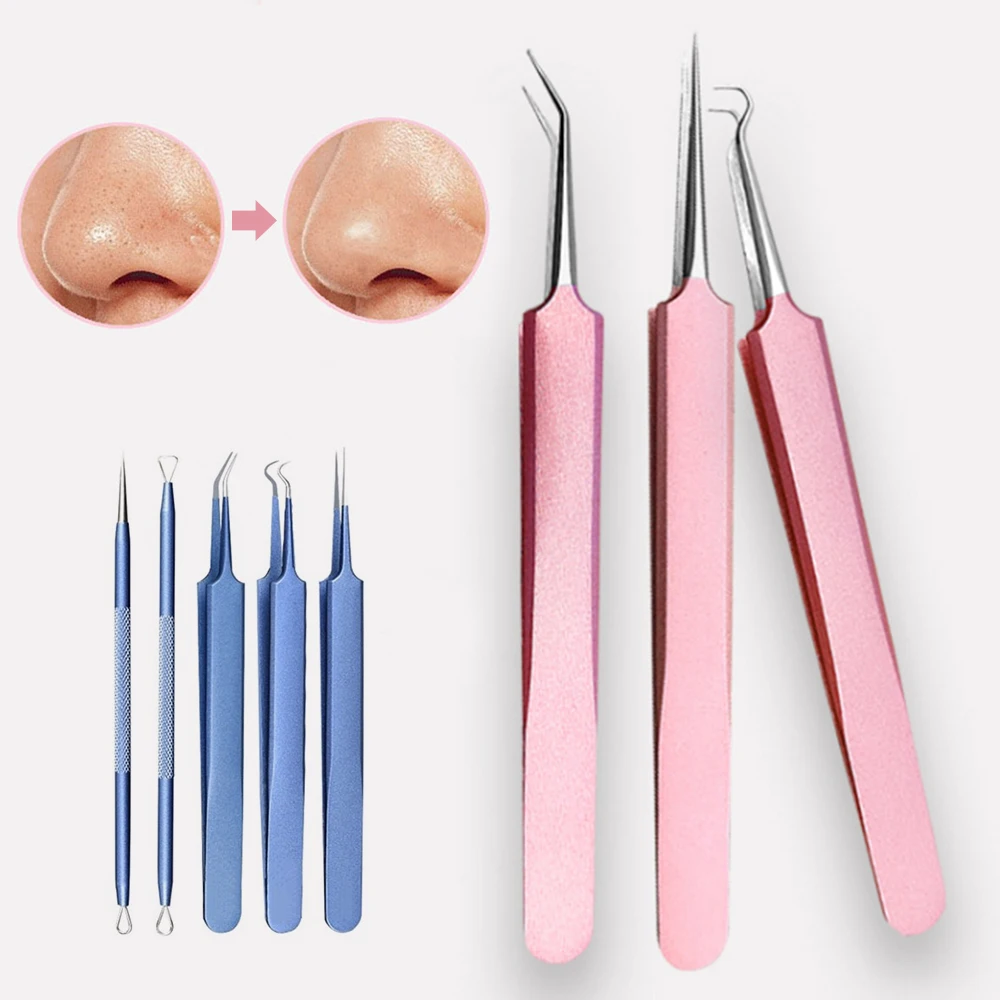 Blue Pink 1PC Acne Comedo Stainless Steel Needle Professional Comedone Blackhead Remover Tweezer For Face Skin Care Tool