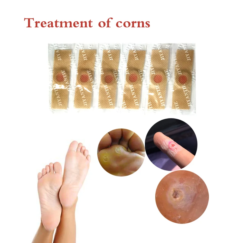 60 шт./лот, медицинский пластырь для удаления мозолей ног, пластырь для удаления мозолей, пластырь для снятия боли