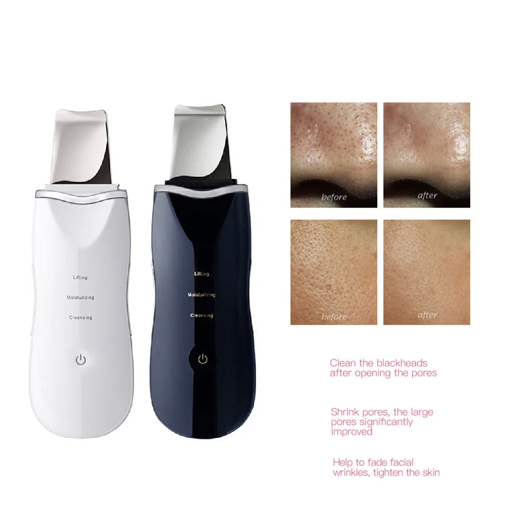 

Rechargeable Ultrasonic Ion Removal Blackhead Reduce Fine Lines Anti Wrinkle Lift Peeling Shovel USB Rechargeable Dropship