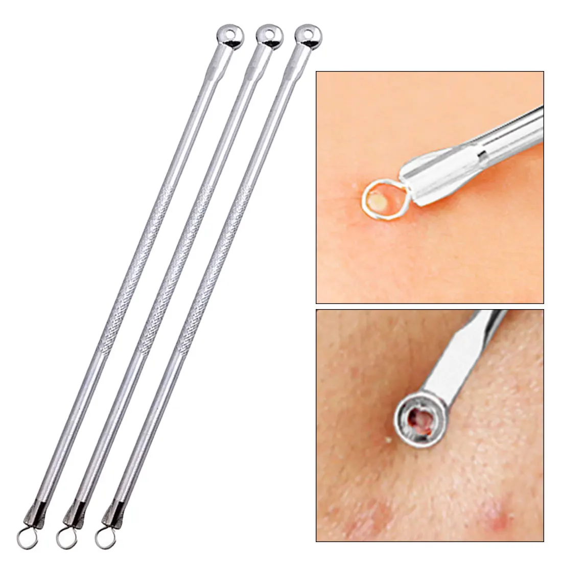 

Beauty Tool Stainless Steel Blackhead Acne Pimple Blemish Extractor Remover Needles Face Skin Care Cleaner Tool Kit