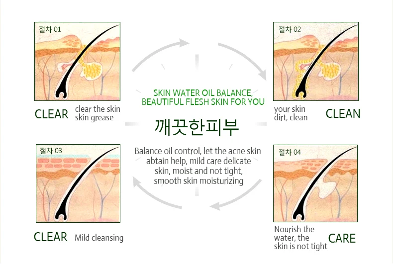 Стремление к леди игровая сессия лечение акне, увлажнение для ухода за кожей, против акне remover лица крем против акне лечения крем для лица с