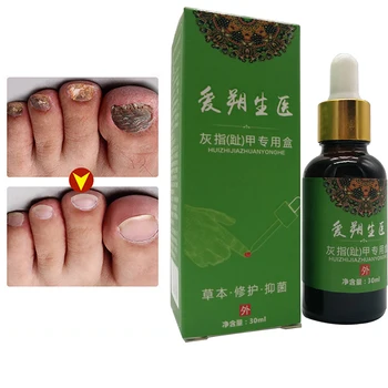 

Kill 99.9% bacteria herbal treatment nail care nail fungal gel bleaching to remove anti-infective onychomycosis paronychia