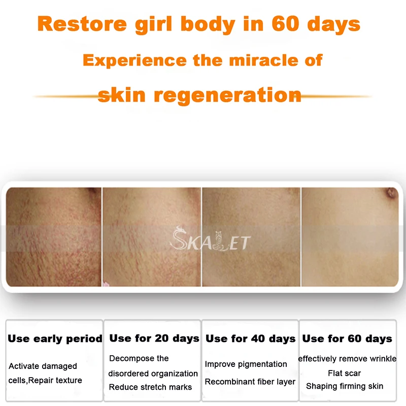 Endurecimento da Pele Cuidados com a Pele Remoção de Gordura Dispositivo da Beleza da Terapia Hottest Ultra-sônica Massagem Emagrecimento 1 Mhz 7 Beleza e saúde
