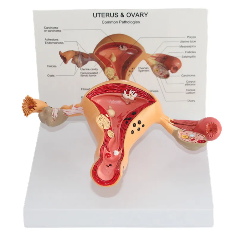 1:1 патологическая матка и яичники анатомическая модель в травме анатомический Скелет зубные анатомические тени спецодежда медицинская