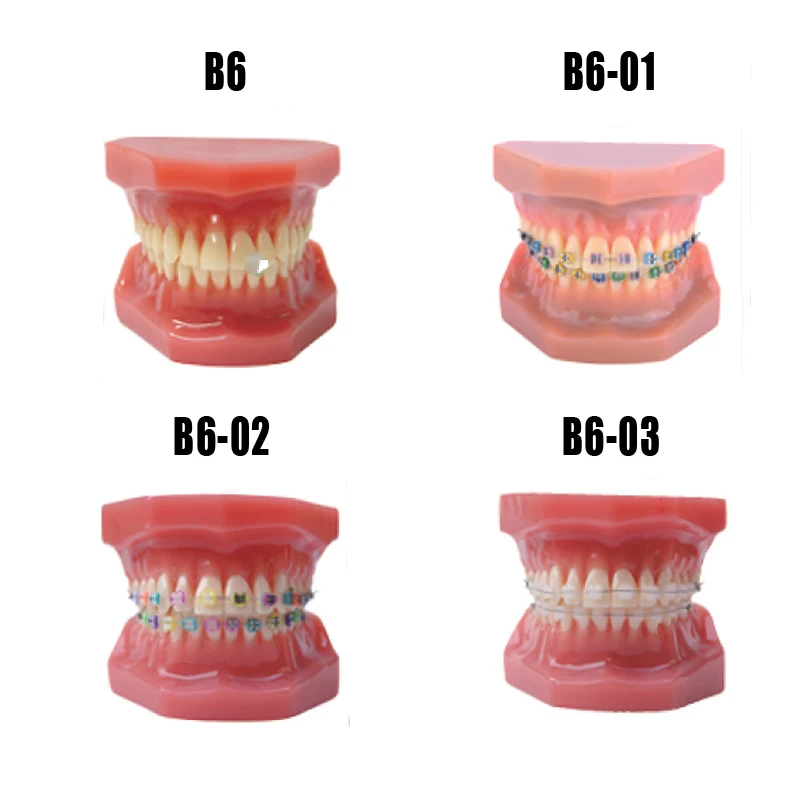 Стоматологическая модель зубов Ортодонтическая модель стоматологический манекен с металлом или керамический кронштейн