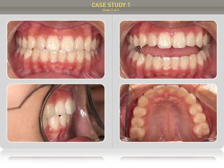 k1_case1_slide3-900x675