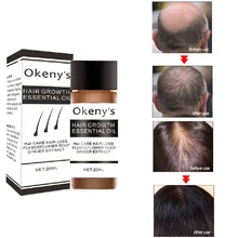 Эссенция для роста волос масло 20 мл против выпадения волос быстро расти плотная сыворотка экстракт имбиря восстановление предотвращения облысения для унисекс TSLM1