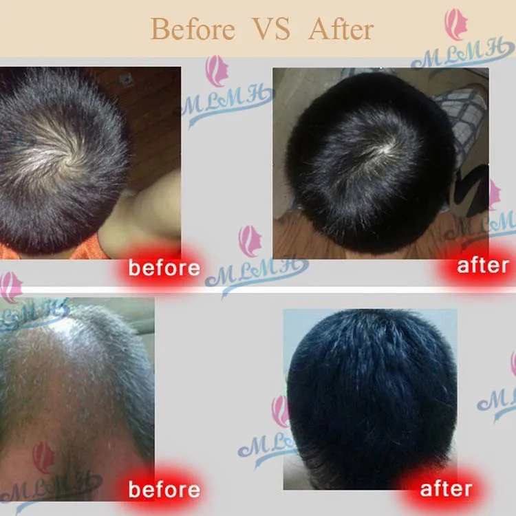 Genuine Professional Hair Ginger Shampoo 300ml Hair Regrowth