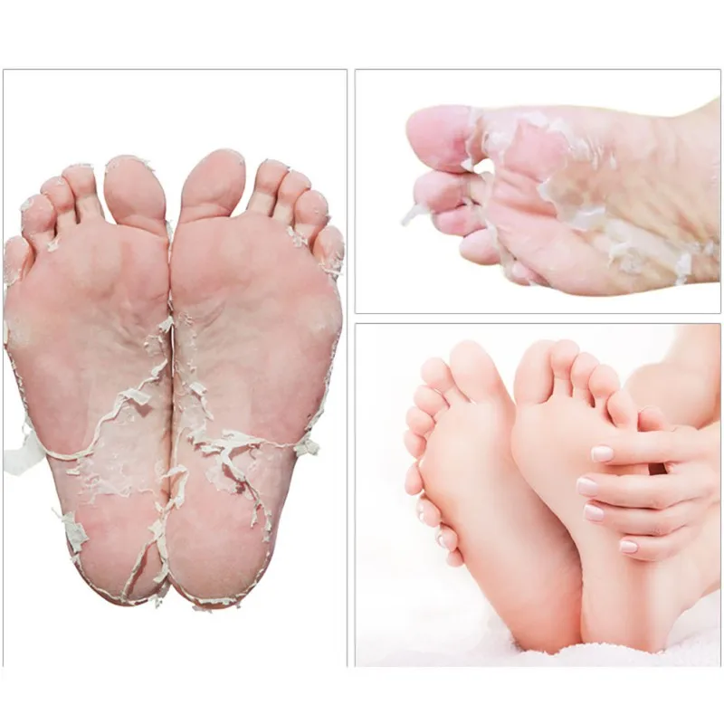 Носка отшелушивать педикюр. Calmia Silky foot peeling пилинг носочки для ног. Exfoliating foot Mask маска носки для ног. Носочки для педикюра отшелушивающие Baby foot.