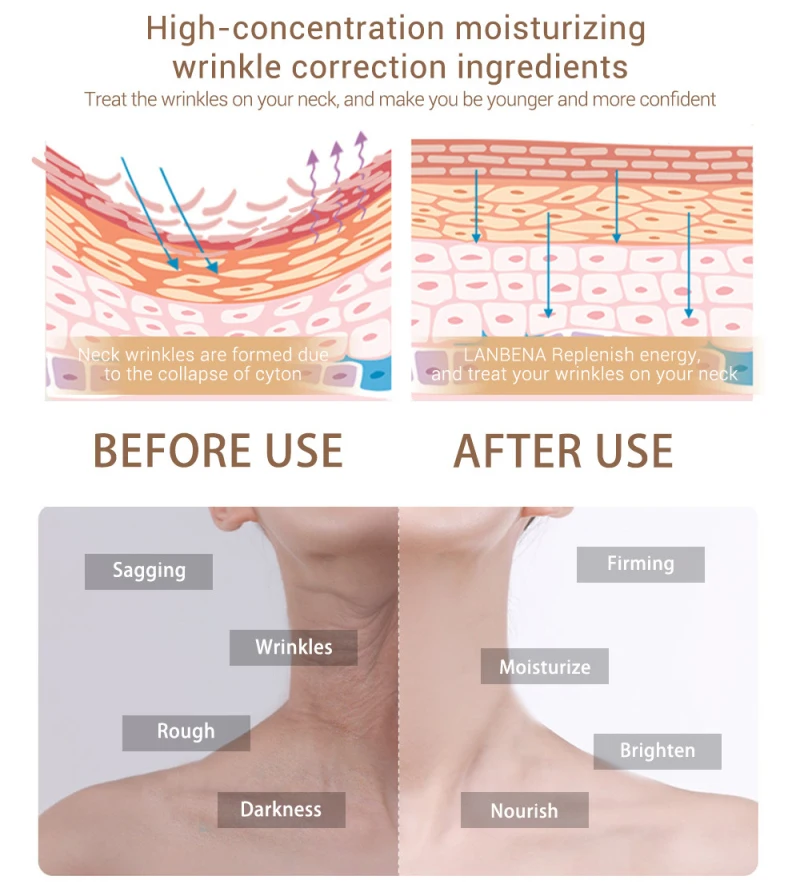 LANBENA крем для шеи электромассажер для лица против морщин кожи смягчающий уход за кожей лифтинг отбеливание увлажняющий, антивозрастной, против старения, уход за кожей женщин TSLM2