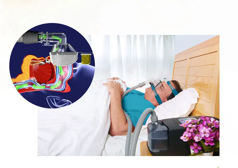 Máquina para Anti-noring Sono e Ronco com Umidificador Cpap Apneia Máscara Mangueira Cartão sd Presente Como Spo2 Kit Frete Grátis Bmc Gii 5 Beleza e saúde