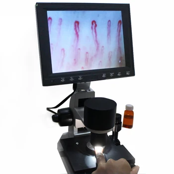 

GY-880 color lcd nailfold capillary microcirculation microscope blood microcirculation
