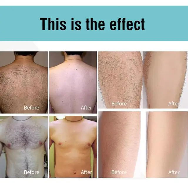 Permanent Growth Inhibitor Hair Repair Smooth Body Removal Aliexpress Permanent Growth Inhibitor Hair Repair Smooth Body Removal Aliexpress