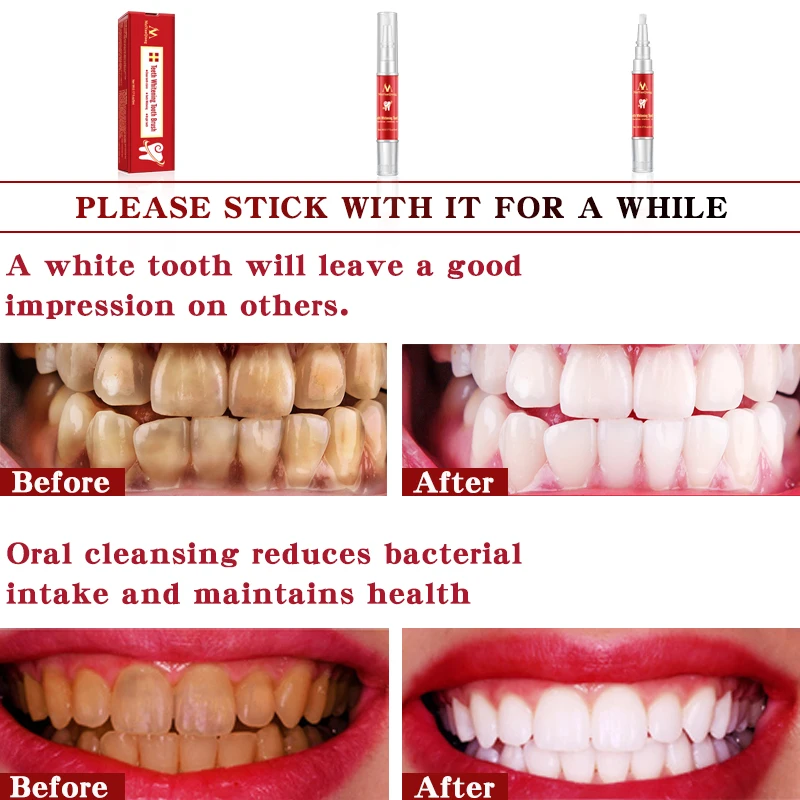 Harga Gigi Sikat Gigi Essence Pembersih Oral Higiene Serum Menghilangkan Plak Noda Gigi Pemutihan Alat Gigi Pasta Gigi