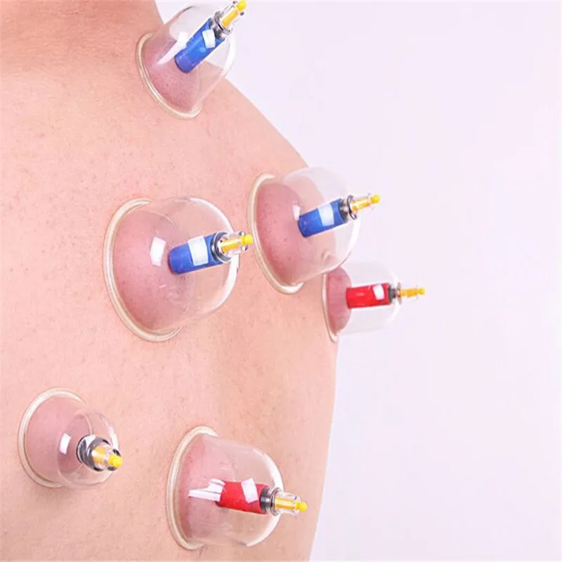 12 Cups Vacuum Cupping Massage  Acupuncture Chinese Vacuum Cupping Suction Therapy Massage Device 5
