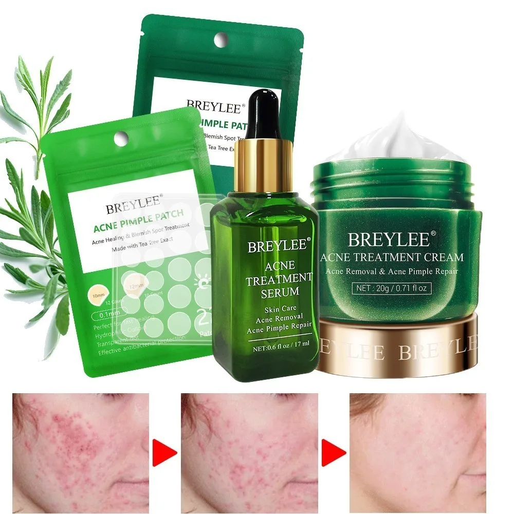 BREYLEE AcnePimple патч лечение акне сыворотка крем для средство удаления прыщей уход за