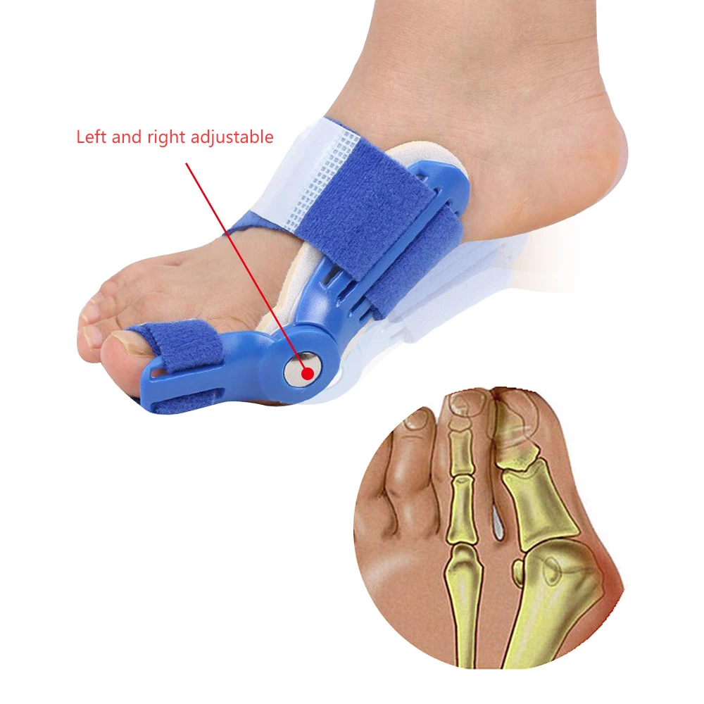 1 пара ортопедические корректоры большого пальца ноги|big toe|toe supportfoot thumb |