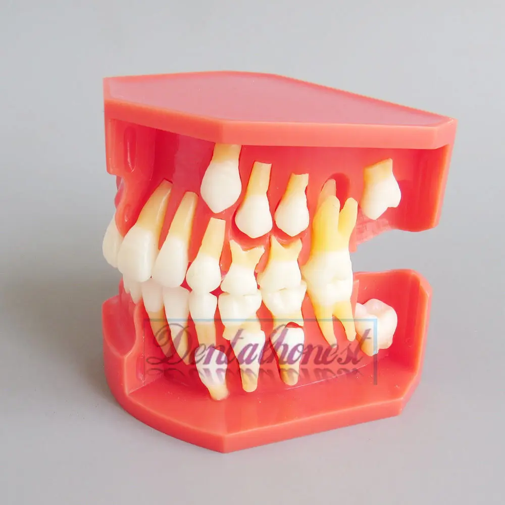 

Children Permanent Tooth Model Alternative Teeth Deciduous Model Removable Demonstration For Kids Studying