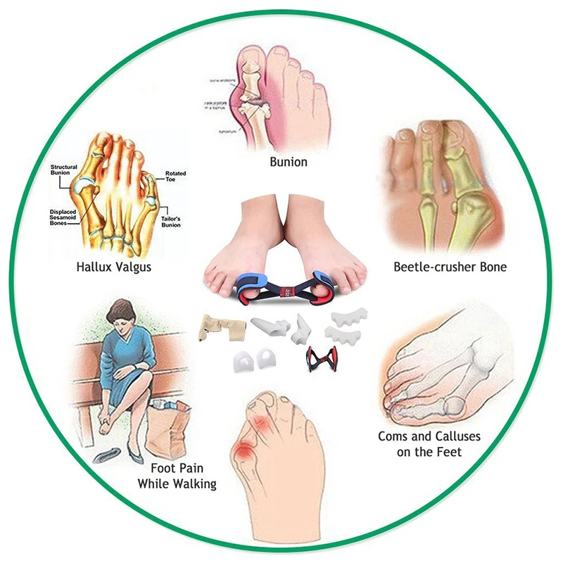 5 шт., комплект защитных втулок для защиты от ожогов, корректор вальгусной деформации, разделители большого пальца, разделители, выпрямители, шина для ухода за ногами