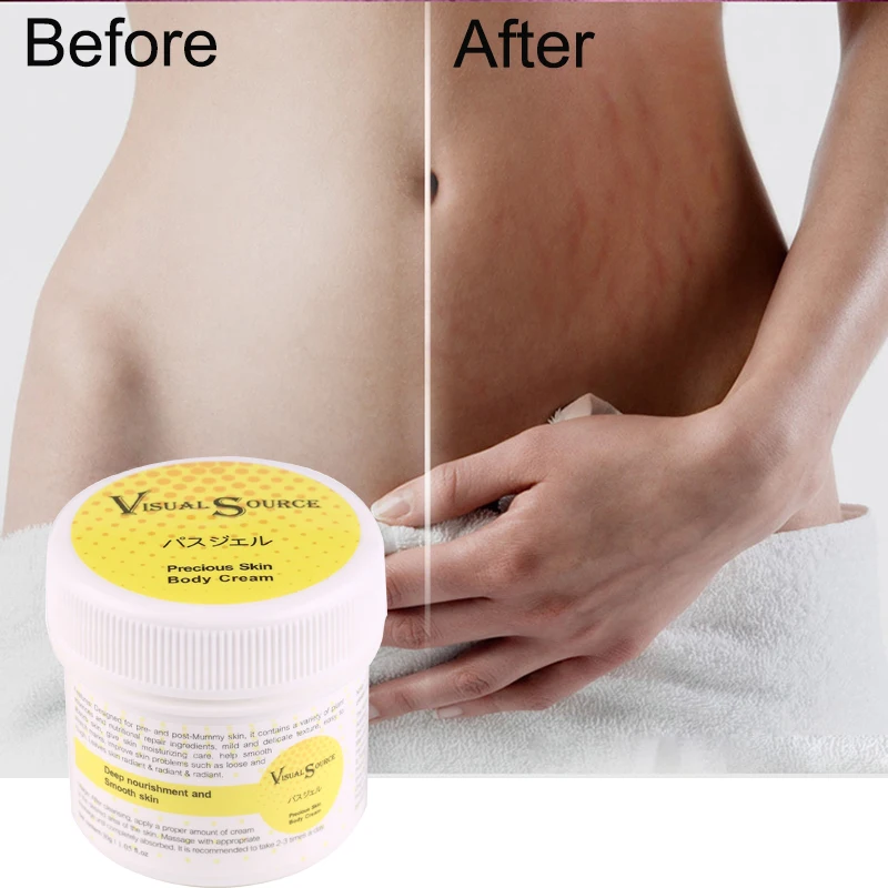 7days Stretch Marks Cream Scar Removal Smooth Skin Cream for Maternity Skin Repair Body Cream Remove Scar Care