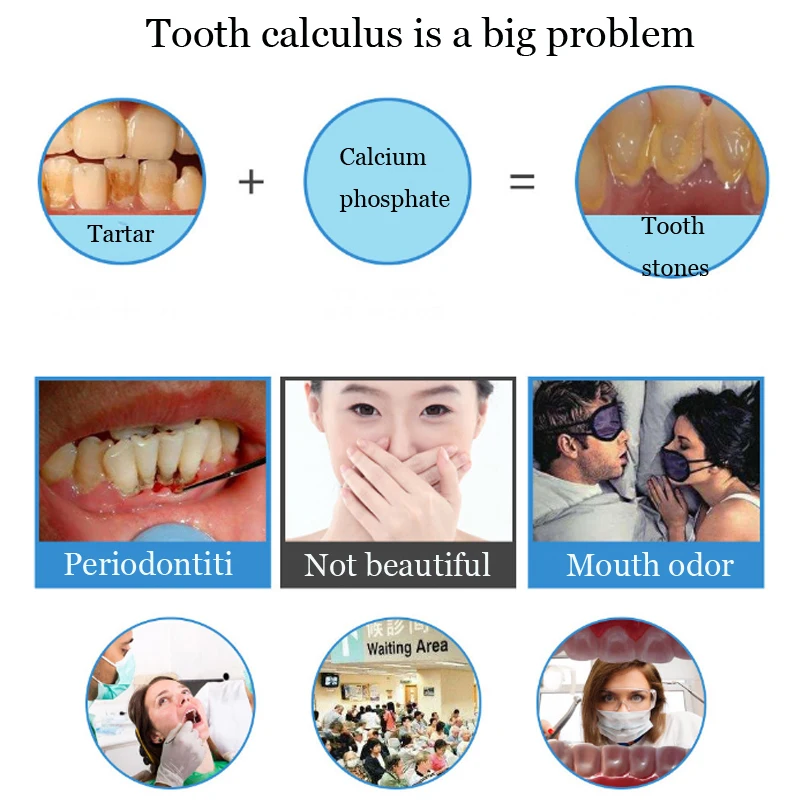 Отбеливание зубов Домашнее использование удаление зубных пятен зубной камень зубы пятна Масштабирование usb зарядка высокая частота вибрации стоматологические инструменты