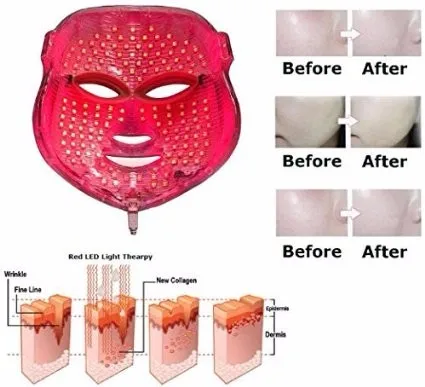 3-Color-LED-Mask-Photon-Light-Skin-Rejuvenation-Therapy-Facial-Mask-Photon-Photodynamics-Beauty-Facial-Peels (2)