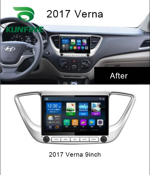Cheap Octa Core Android 8.1 4GB RAM 64G ROM Car DVD GPS Navigation Player Deckless Car Stereo for Hyundai  Verna 2016 2017  Radio 1