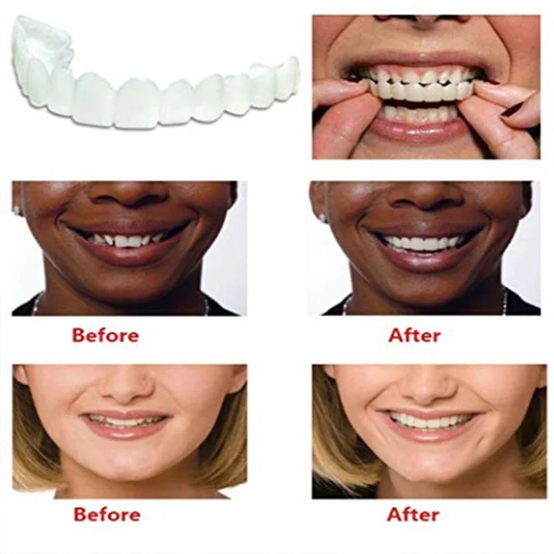 Beautiful Comfort Fit Flex Cosmetic Teeth Denture Teeth Top Cosmetic Veneer