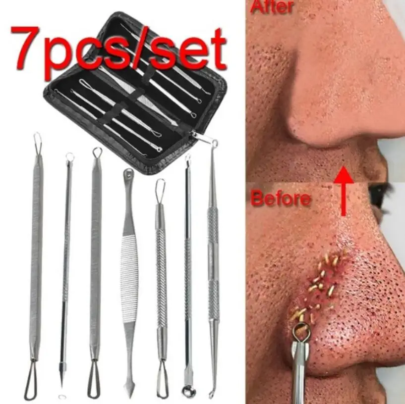 3 4 5 7 8 Pc Stainless Steel Blackhead Remover Tool Kit Whitehead
