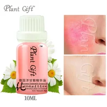 Акция! Пособия по немецкому языку сущность масло ромашки 10 мл/30 мл увлажнение кожи ремонт Удаление предотвратить аллергия красный крови