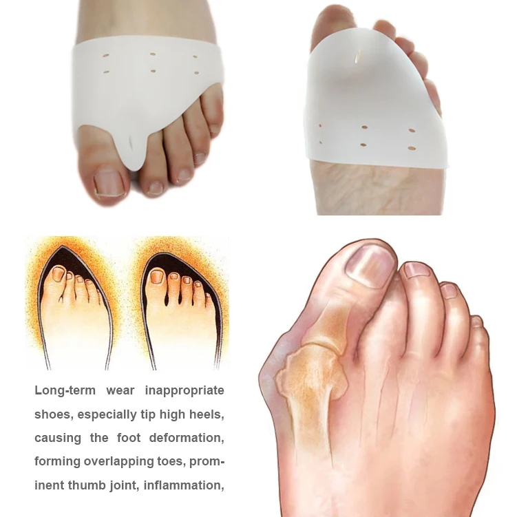 1pair=2ps Daily use Silicone Gel foot fingers Toe Separator thumb valgus protector Bunion adjuster Hallux Valgus Guard feet care