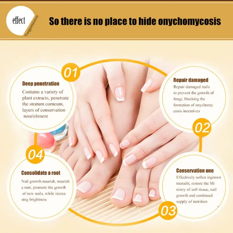 1 шт 30 мл против грибковых ногтей Лечение пальцев ног грибок инфекция естественное лечение