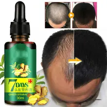 ReGrow - 7 gün zencefil Germinal saç büyüme serumu özü yağı saç dökülmesi bina dökülmesi tedavisi büyüme saç erkekler için kadın