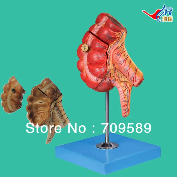 ISO  Anatomical Model of Appendix and Caecum, Human appendix