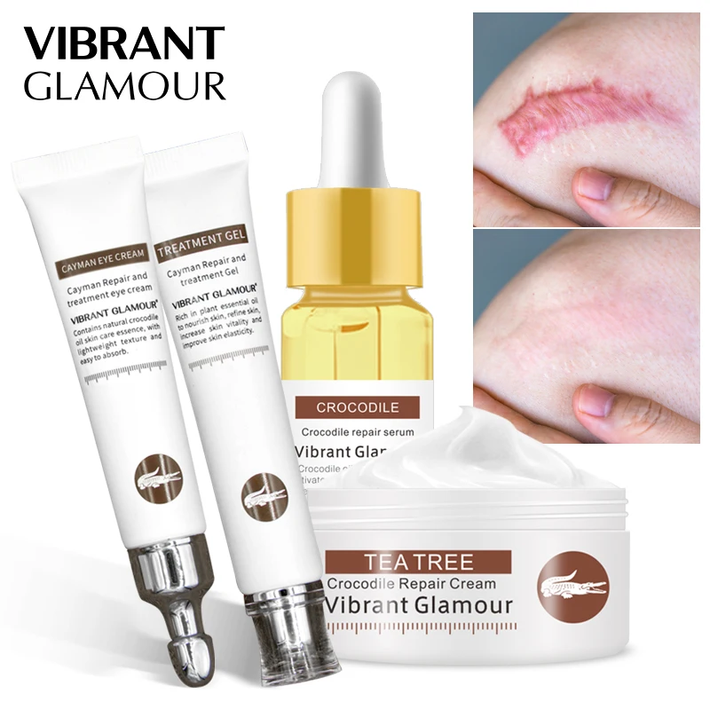 VIBRANT GLAMOUR Repair Scar Face Cream Eye Cream Serum Crocodile Set Whitening Remove Stretch Marks Skin Care Cream Anti-Aging