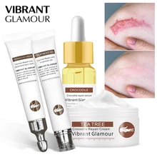 VIBRANT GLAMOUR Repair Scar Face Cream Eye Cream Serum Crocodile Set Whitening Remove Stretch Marks Skin Care Cream Anti-Aging