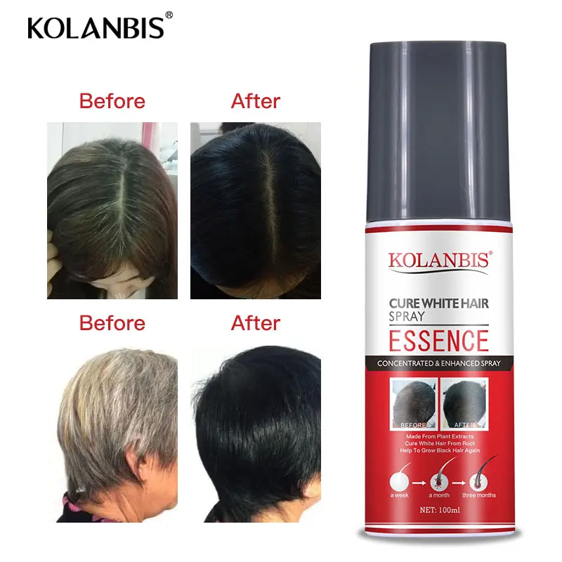 Sac Spreyi Buyulu Cin Bitkisel Ilac Dogal Beyaz Sac Tedavisi Ozu Siyah Sac Kararan Anti Gri Sac Hair Scalp Treatments Aliexpress