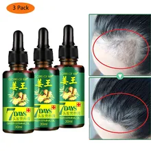 Естественное восстановление быстрый рост волос флюид лечение выпадения волос здоровый рост волос биотин эссенция лечение выпадения волос питание инструмент