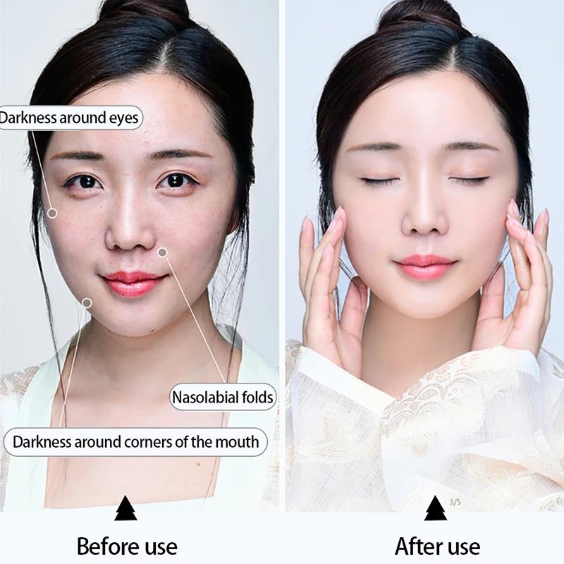 Skup MEIKING kwas hialuronowy serum do twarzy kolagen przeciw zmarszczkom zmniejszyć pory Essence Anti aging wybielanie olejek nawilżający pielęgnacja skóry