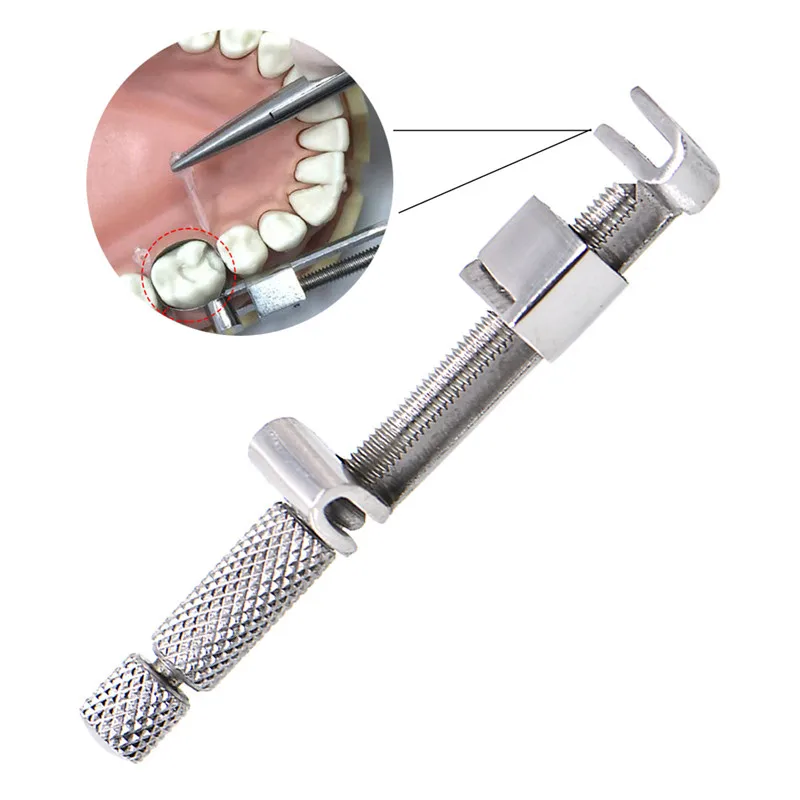 1 шт. Tofflimire стоматологический матричный ленточный фиксатор формирующий опорный пленочный формовочный зажим Универсальный стоматологический матричный зажим