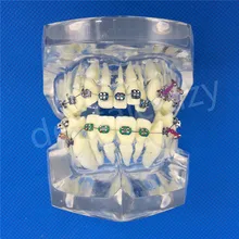 Стоматологические модели зубов используются для обучения и больничной стоматологической мальокклюзии ортодонтической модели